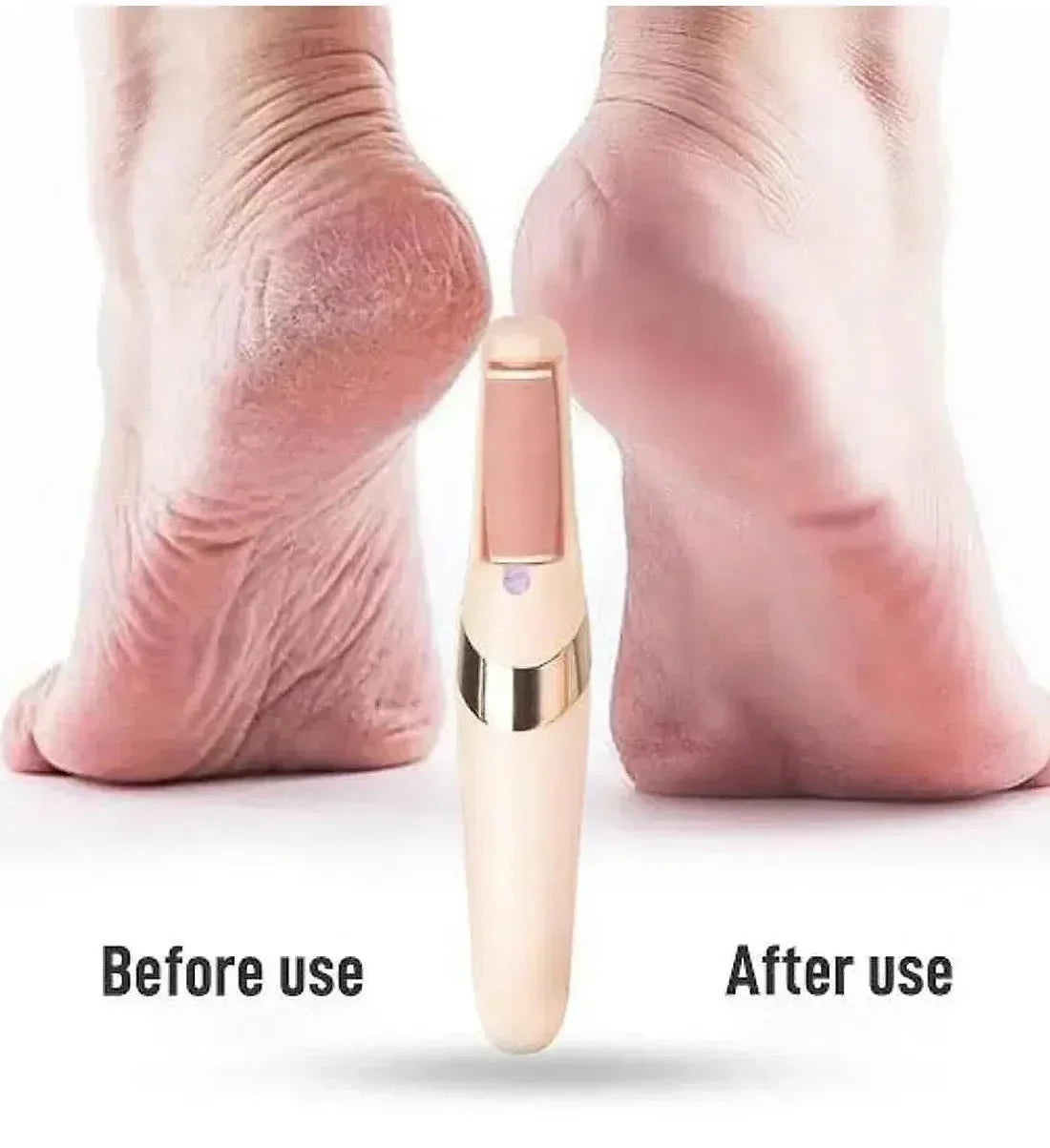FawaQa | WEIMEI Rechargeable Electric Foot File Callus Remover for Wet & Dry Pedicure - FawaQa